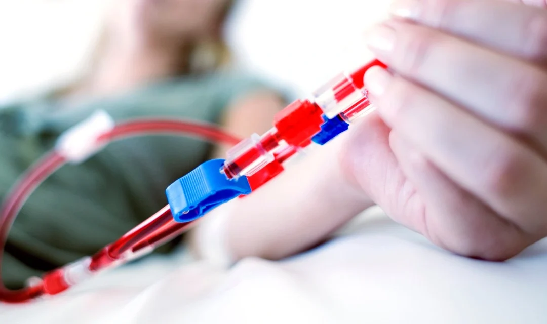 Conheça os tipos de acesso vascular para hemodiálise