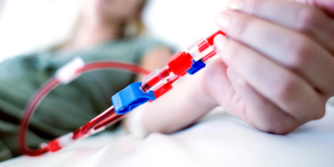 Conheça os tipos de acesso vascular para hemodiálise