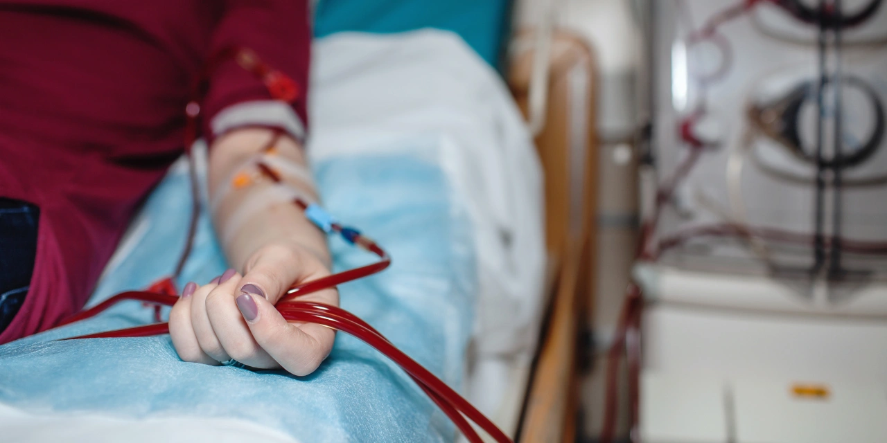 Tudo o que você precisa saber sobre fístula arteriovenosa para hemodiálise.